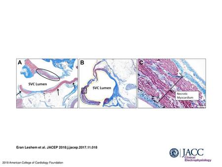 Eran Leshem et al. JACEP 2018;j.jacep