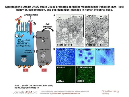 Diarrheagenic Afa/Dr DAEC strain C1845 promotes epithelial-mesenchymal transition (EMT)-like behavior, cell extrusion, and pks-dependent damage in human.