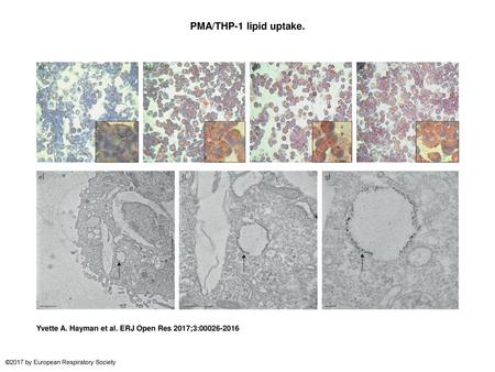 PMA/THP-1 lipid uptake. PMA/THP-1 lipid uptake. PMA/THP-1 cells were incubated with 10% vol/vol Calogen for 24 h with and without inhibitors and were stained.