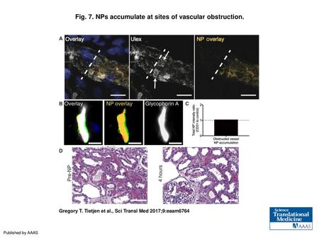 Fig. 7. NPs accumulate at sites of vascular obstruction.