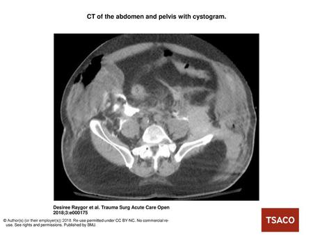 CT of the abdomen and pelvis with cystogram.