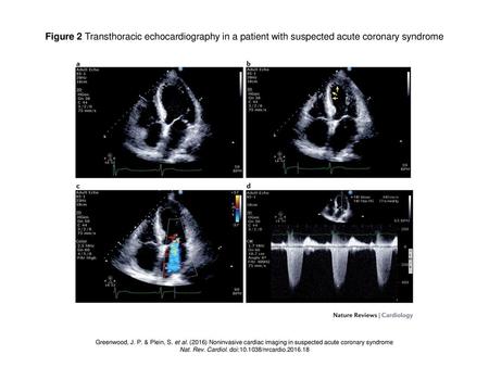 Nat. Rev. Cardiol. doi: /nrcardio