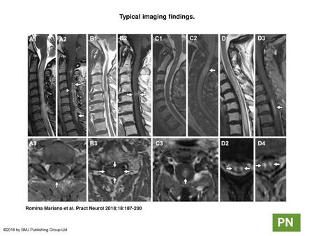 Typical imaging findings.