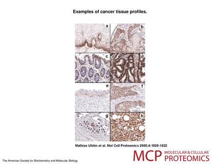 Examples of cancer tissue profiles.