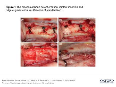 Figure 1 The process of bone defect creation, implant insertion and ridge augmentation. (a) Creation of standardized ... Figure 1 The process of bone defect.