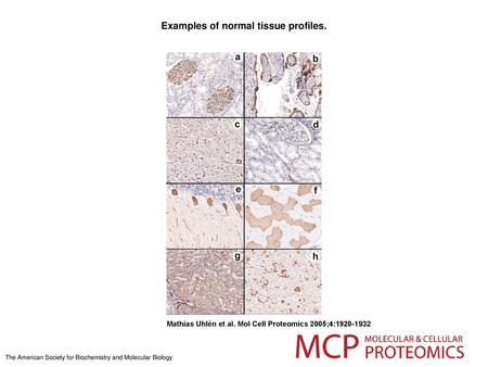 Examples of normal tissue profiles.