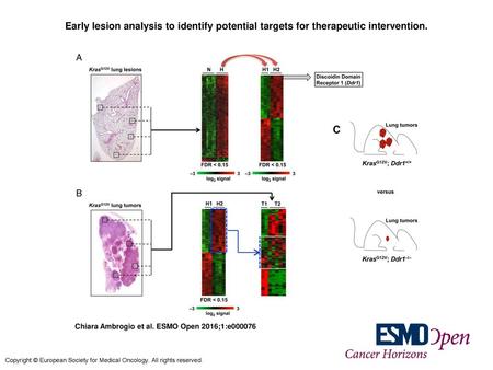 Early lesion analysis to identify potential targets for therapeutic intervention. Early lesion analysis to identify potential targets for therapeutic intervention.