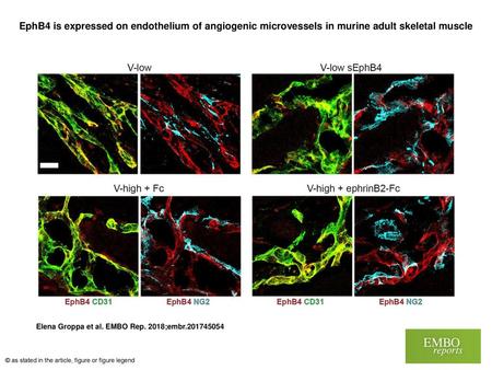 EphB4 is expressed on endothelium of angiogenic microvessels in murine adult skeletal muscle EphB4 is expressed on endothelium of angiogenic microvessels.