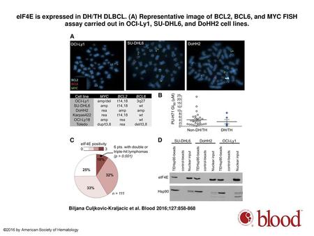 eIF4E is expressed in DH/TH DLBCL