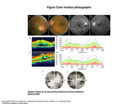 Figure Color fundus photographs