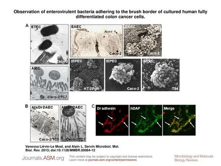 Observation of enterovirulent bacteria adhering to the brush border of cultured human fully differentiated colon cancer cells. Observation of enterovirulent.