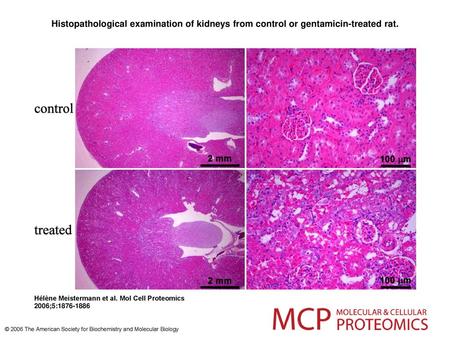 Histopathological examination of kidneys from control or gentamicin-treated rat. Histopathological examination of kidneys from control or gentamicin-treated.