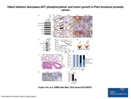 Hdac3 deletion decreases AKT phosphorylation and tumor growth in Pten knockout prostate cancer Hdac3 deletion decreases AKT phosphorylation and tumor growth.