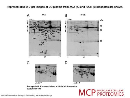 Representative 2-D gel images of UC plasma from AGA (A) and IUGR (B) neonates are shown. Representative 2-D gel images of UC plasma from AGA (A) and IUGR.