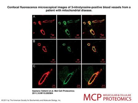 Confocal fluorescence microscopical images of 3-nitrotyrosine-positive blood vessels from a patient with mitochondrial disease. Confocal fluorescence microscopical.