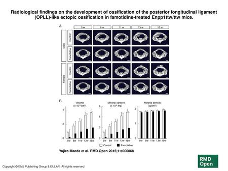 Radiological findings on the development of ossification of the posterior longitudinal ligament (OPLL)-like ectopic ossification in famotidine-treated.