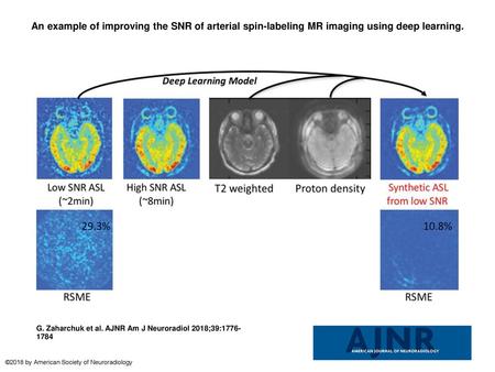 An example of improving the SNR of arterial spin-labeling MR imaging using deep learning. An example of improving the SNR of arterial spin-labeling MR.