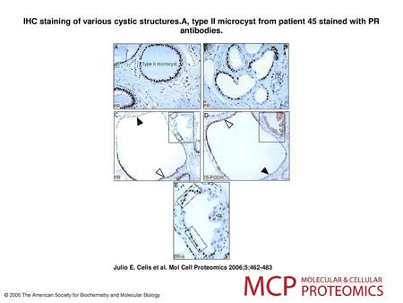 IHC staining of various cystic structures