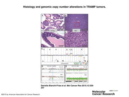 Histology and genomic copy number alterations in TRAMP tumors.