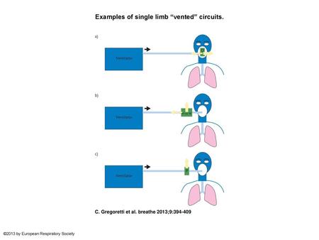 Examples of single limb “vented” circuits.