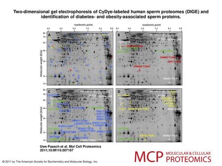 Two-dimensional gel electrophoresis of CyDye-labeled human sperm proteomes (DIGE) and identification of diabetes- and obesity-associated sperm proteins.