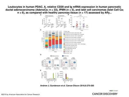 Leukocytes in human PDAC