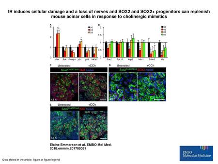 IR induces cellular damage and a loss of nerves and SOX2 and SOX2+ progenitors can replenish mouse acinar cells in response to cholinergic mimetics IR.