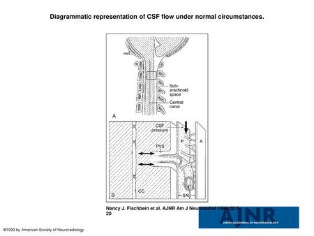 Diagrammatic representation of CSF flow under normal circumstances.