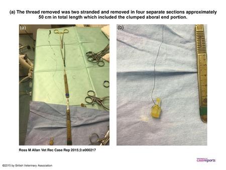 (a) The thread removed was two stranded and removed in four separate sections approximately 50 cm in total length which included the clumped aboral end.