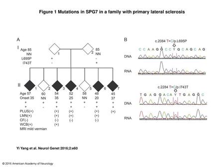 Figure 1 Mutations in SPG7 in a family with primary lateral sclerosis