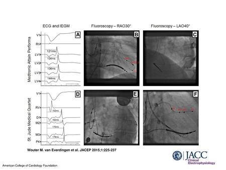 Wouter M. van Everdingen et al. JACEP 2015;1: