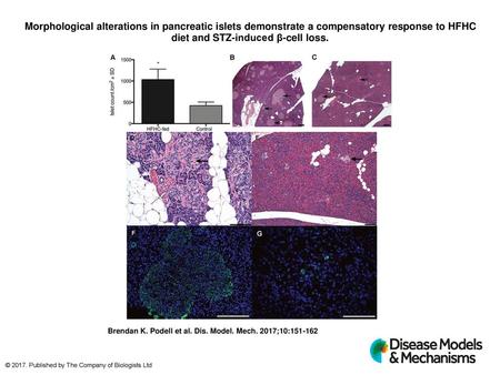 Morphological alterations in pancreatic islets demonstrate a compensatory response to HFHC diet and STZ-induced β-cell loss. Morphological alterations.