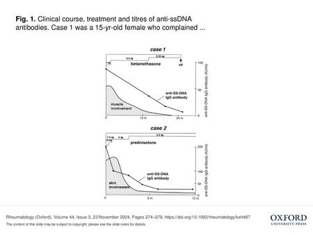 Fig. 1. Clinical course, treatment and titres of anti-ssDNA antibodies