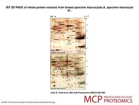 IEF 2D PAGE of whole protein extracts from breast apocrine macrocysts