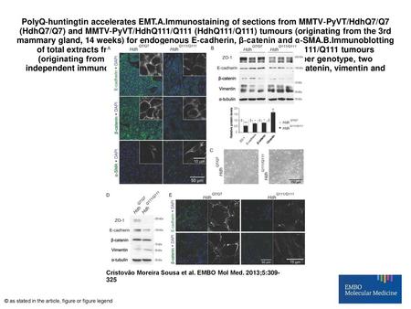 PolyQ‐huntingtin accelerates EMT. A