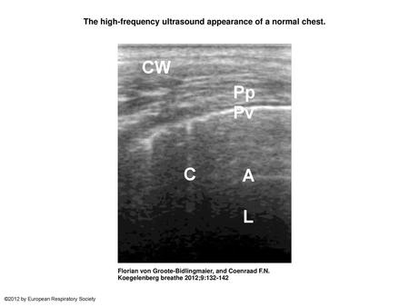 The high-frequency ultrasound appearance of a normal chest.