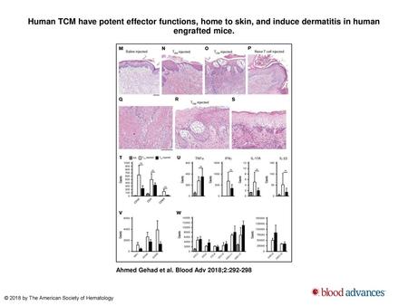 Human TCM have potent effector functions, home to skin, and induce dermatitis in human engrafted mice. Human TCMhave potent effector functions, home to.