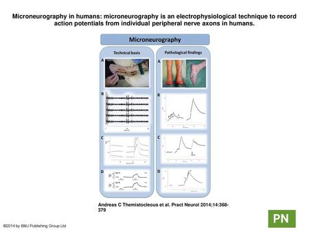 Microneurography in humans: microneurography is an electrophysiological technique to record action potentials from individual peripheral nerve axons in.