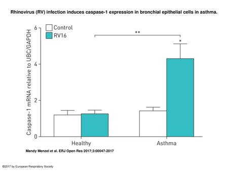 Rhinovirus (RV) infection induces caspase-1 expression in bronchial epithelial cells in asthma. Rhinovirus (RV) infection induces caspase-1 expression.