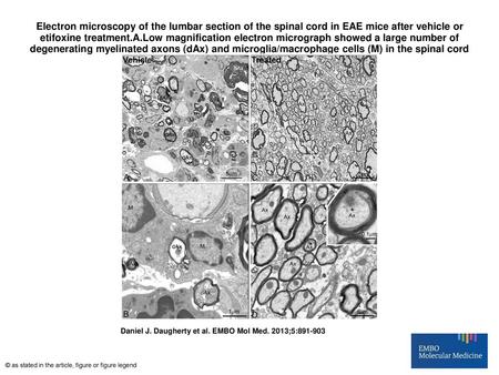 Electron microscopy of the lumbar section of the spinal cord in EAE mice after vehicle or etifoxine treatment.A.Low magnification electron micrograph showed.