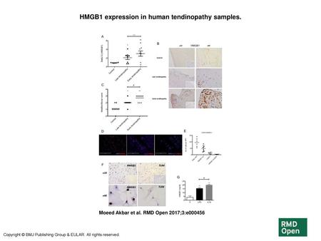 HMGB1 expression in human tendinopathy samples.