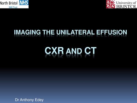 Imaging the unilateral effusion CXR and CT