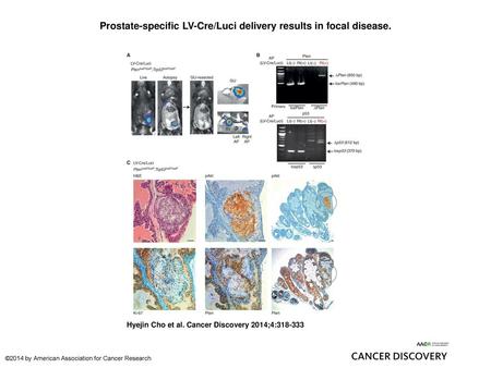 Prostate-specific LV-Cre/Luci delivery results in focal disease.