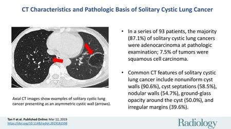 CT Characteristics and Pathologic Basis of Solitary Cystic Lung Cancer