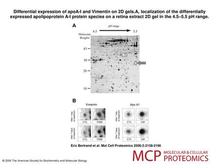 Differential expression of apoA-I and Vimentin on 2D gels