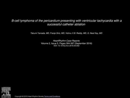 B-cell lymphoma of the pericardium presenting with ventricular tachycardia with a successful catheter ablation  Takumi Yamada, MD, Franjo Siric, MD, Vishnu.