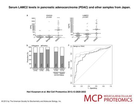 Serum LAMC2 levels in pancreatic adenocarcinoma (PDAC) and other samples from Japan. Serum LAMC2 levels in pancreatic adenocarcinoma (PDAC) and other samples.