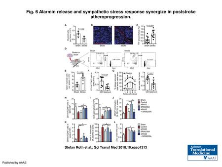 Fig. 6 Alarmin release and sympathetic stress response synergize in poststroke atheroprogression. Alarmin release and sympathetic stress response synergize.