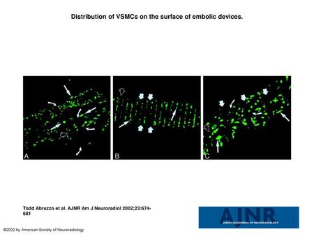 Distribution of VSMCs on the surface of embolic devices.