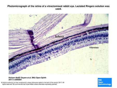 Photomicrograph of the retina of a vitrectomised rabbit eye